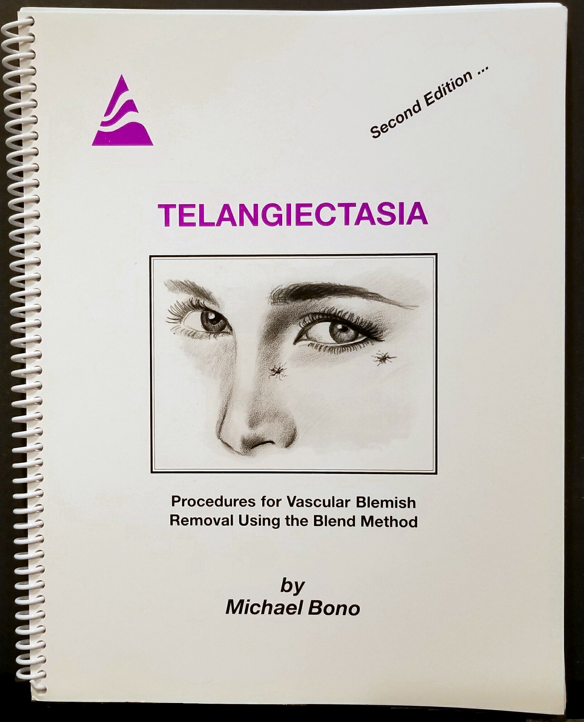 Teleangiectasy Telangiectasia - 2nd Edition | Michael Bono - A & E Beauty Supplies